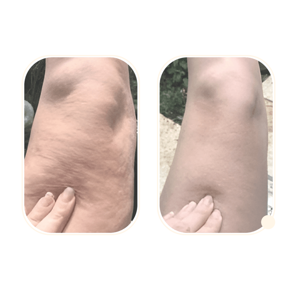 3r centre de bien etre, Nos packs Anti cellulite ,Tetouan